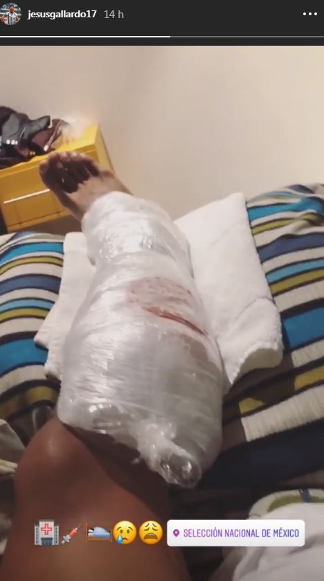 Gallardo se lesionó durante el juego entre Rayados y Puebla