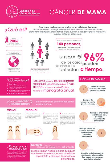 ¿Qué es el cáncer de mama?