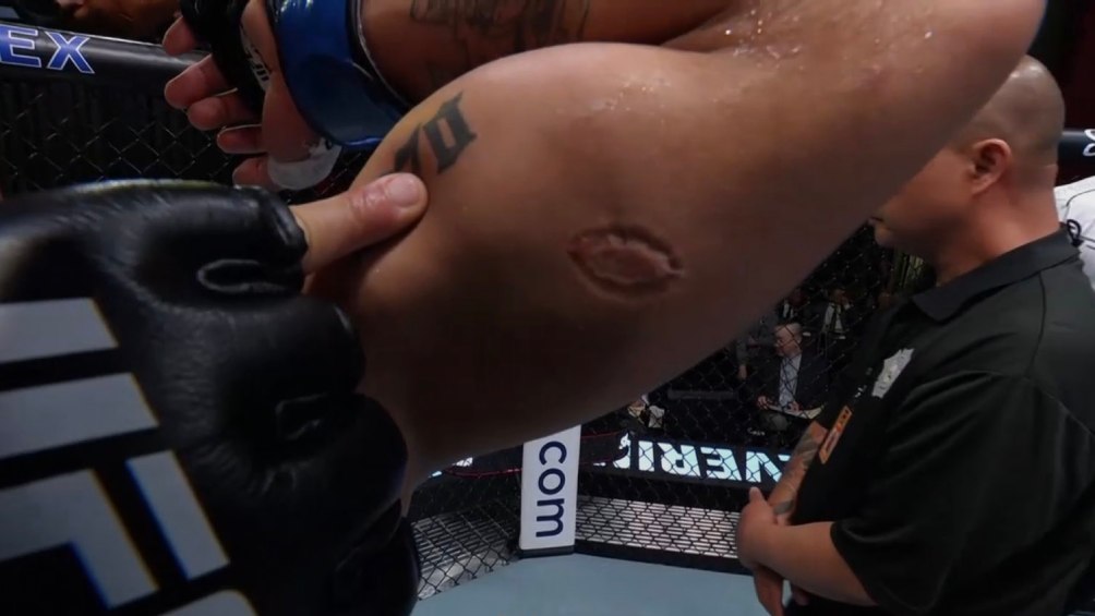 Lima enseñando a las camaras de la UFC la mordida