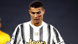 Serie A: ¿Por qué los jugadores lucieron una marca roja en la cara?